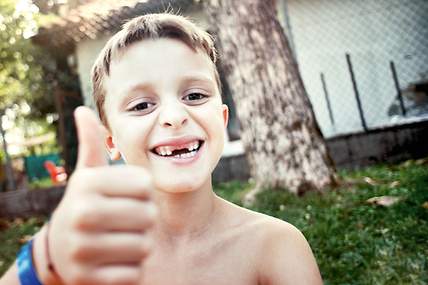 Das Bild zeigt ein Kind, das mit fehlenden Zähnen lächelt und einen Daumen nach oben zeigt.