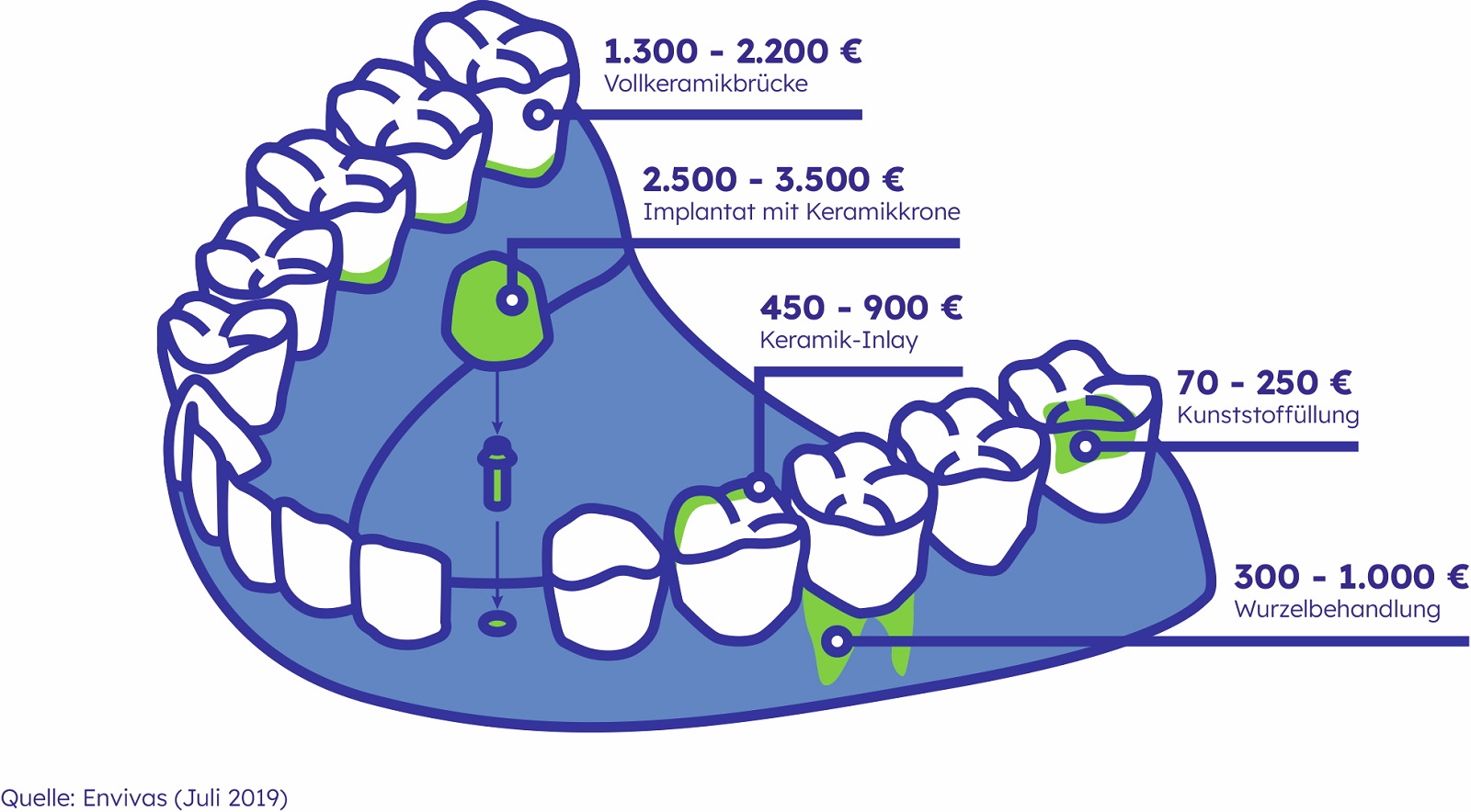 Die Grafik zeigt einen Kiefer mit verschiedenen Zahnbehandlungen und Zahnersatz sowie deren Kosten. 