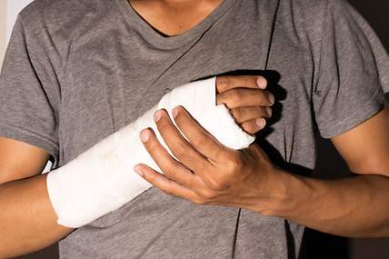 Unfallversicherung Haushalt: Gebrochenes Handgelenk – Header-Bild